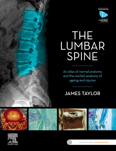Book cover of: Lumbar Spine. By: James Taylor