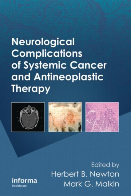 Book cover of: Neurological Complications of Systemic Cancer and Antineoplastic Therapy