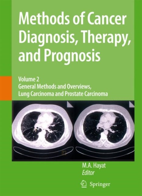 Book cover of: Methods of Cancer Diagnosis, Therapy and Prognosis. By: M. A. Hayat
