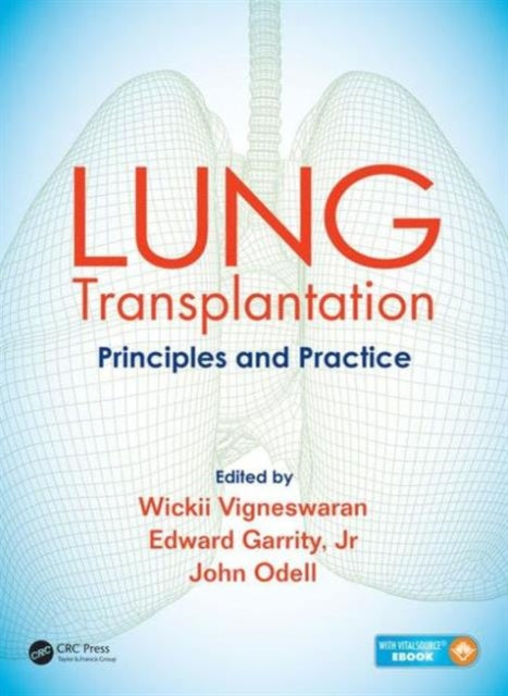 Book cover of: Lung Transplantation. By: Wickii Vigneswaran