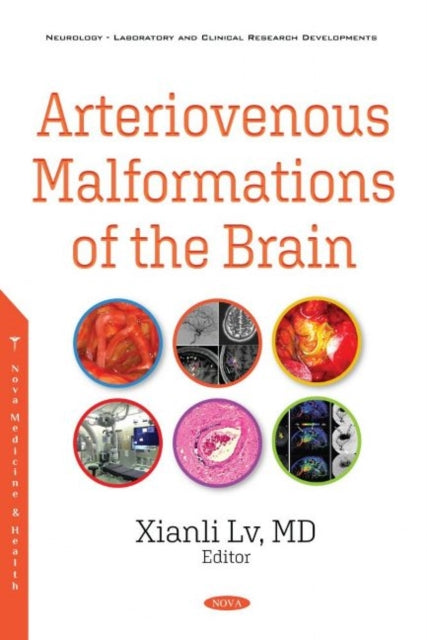 Book cover of: Arteriovenous Malformations of the Brain. By: Xianli Lv