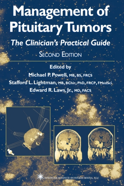Book cover of: Management of Pituitary Tumors. By: Michael P. Powell