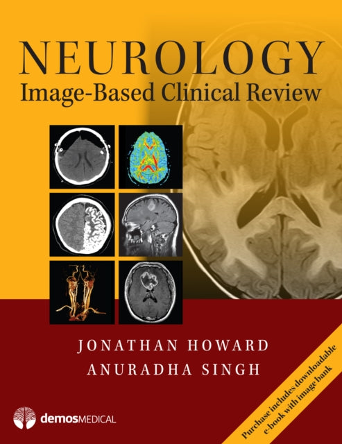 Book cover of: Neurology Image-Based Clinical Review. By: Jonathan Howard