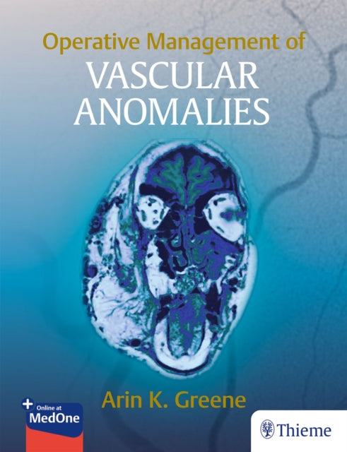 Book cover of: Operative Management of Vascular Anomalies. By: Arin K. Greene