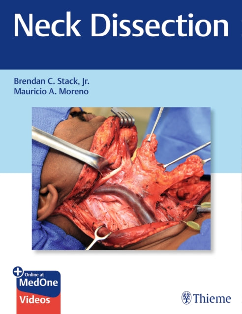 Book cover of: Neck Dissection. By: Brendan Stack Jr.