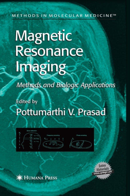 Book cover of: Magnetic Resonance Imaging. By: Pottumarthi V. Prasad