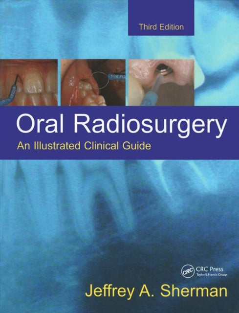 Book cover of: Oral Radiosurgery. By: Jeffrey A. Sherman