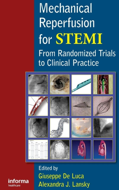Book cover of: Mechanical Reperfusion for STEMI