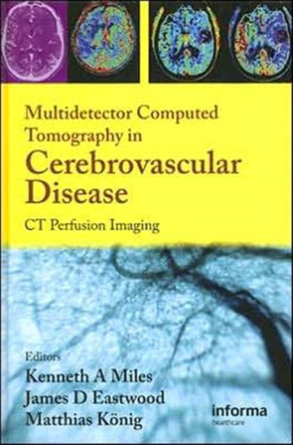 Book cover of: Multidetector Computed Tomography in Cerebrovascular Disease