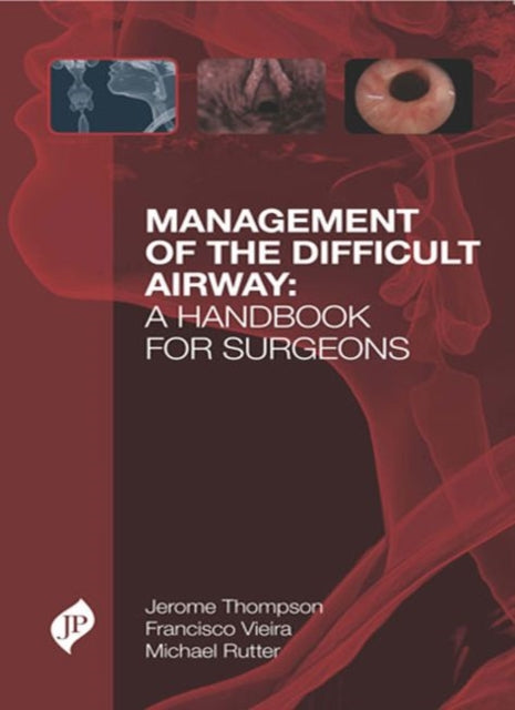 Book cover of: Management of the Difficult Airway: A Handbook for Surgeons. By: Jerome W. Thompson