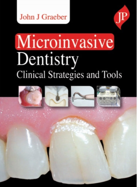 Book cover of: Microinvasive Dentistry. By: GRAEBER