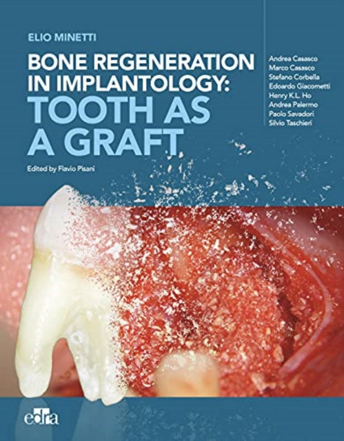 Book cover of: Bone regeneration in implantology - tooth as a graft. By: Elio Minetti