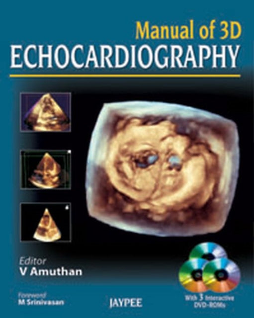Book cover of: Manual of 3D Echocardiography