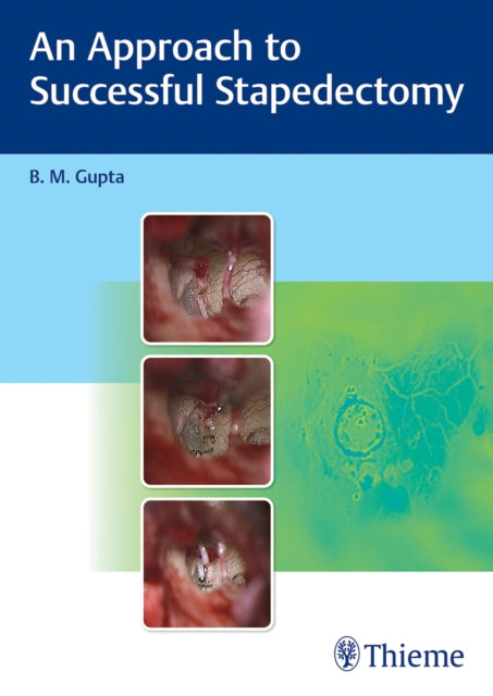 Book cover of: Approach to Successful Stapedectomy. By: B. Gupta