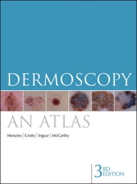 Book cover of: Dermoscopy. By: Scott W. Menzies