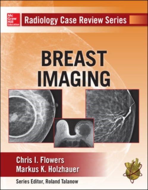 Book cover of: Radiology Case Review Series: Breast Imaging