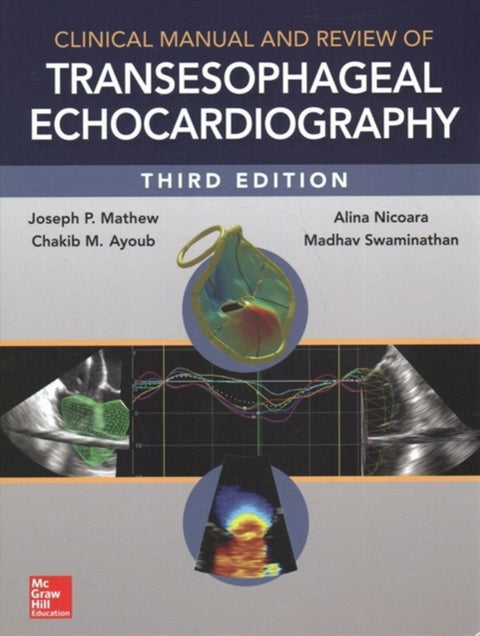 Clinical Manual and Review of Transesophageal Echocardiography, 3/e