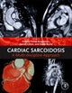 Book cover of: Cardiac Sarcoidosis. By: Robert Phillip Baughman