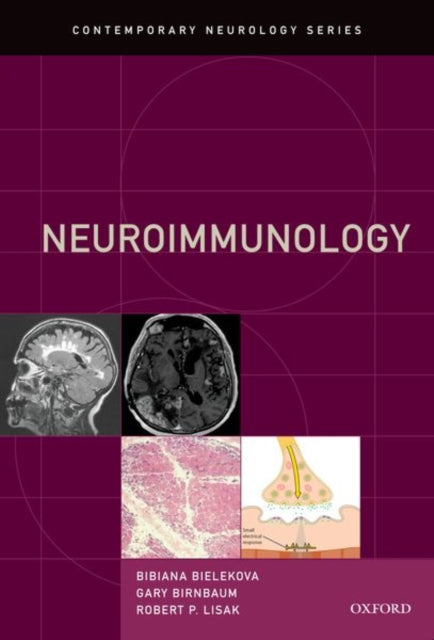 Book cover of: Neuroimmunology. By: Bibiana Bielekova