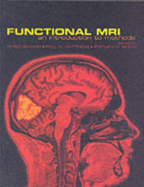 Book cover of: Functional Magnetic Resonance Imaging