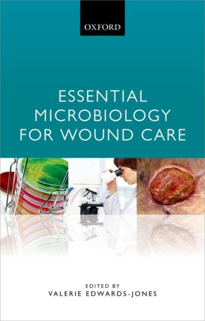 Book cover of: Essential Microbiology for Wound Care. By: Valerie Edwards-Jones
