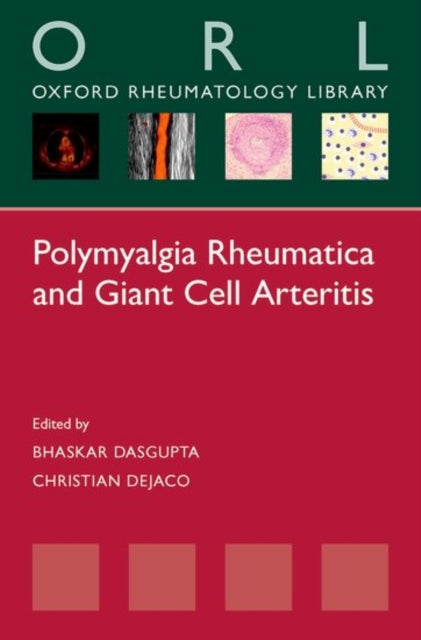 Book cover of: Polymyalgia Rheumatica and Giant Cell Arteritis