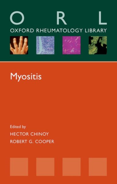 Book cover of: Myositis. By: Hector Chinoy