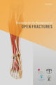 Book cover of: Standards for the Management of Open Fractures. By: Simon Eccles
