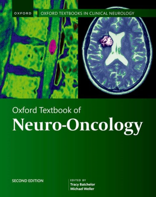 Book cover of: Oxford Textbook of Neuro-Oncology