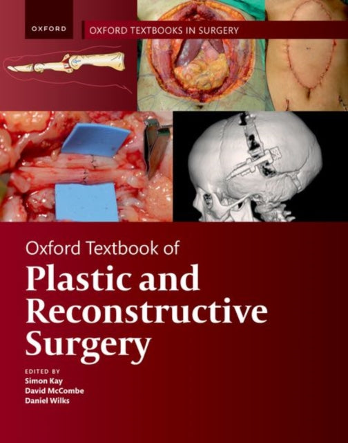 Book cover of: Oxford Textbook of Plastic and Reconstructive Surgery. By: Simon Kay