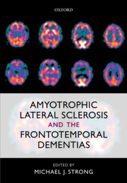 Book cover of: Amyotrophic Lateral Sclerosis and the Frontotemporal Dementias