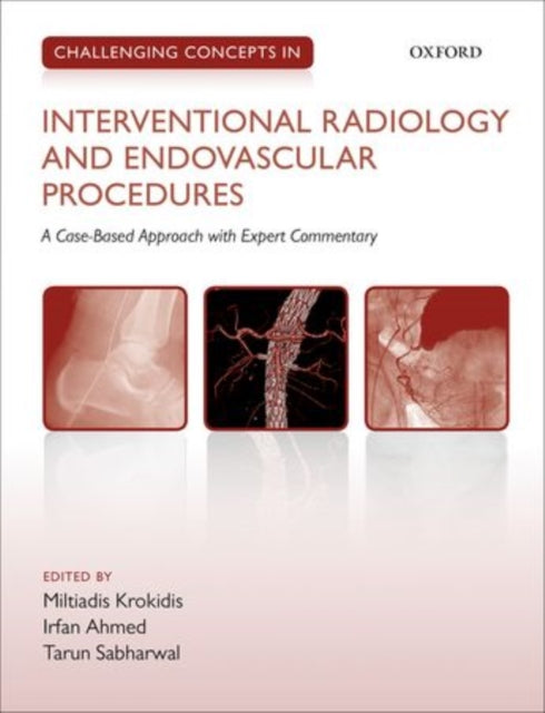 Book cover of: Challenging Concepts in Interventional Radiology. By: Miltiadis Krokidis