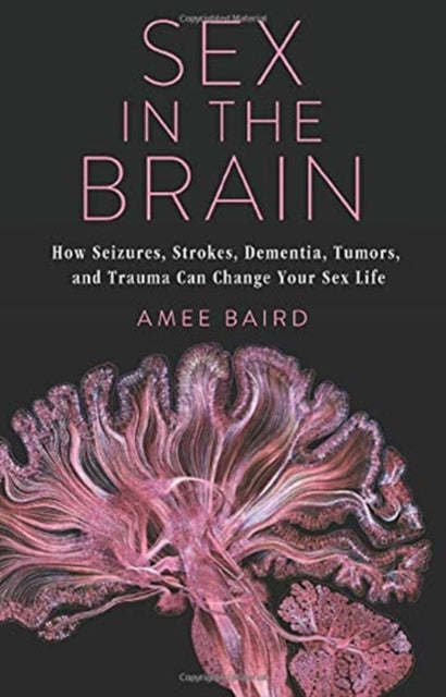 Book cover of: Sex in the Brain. By: Amee Baird