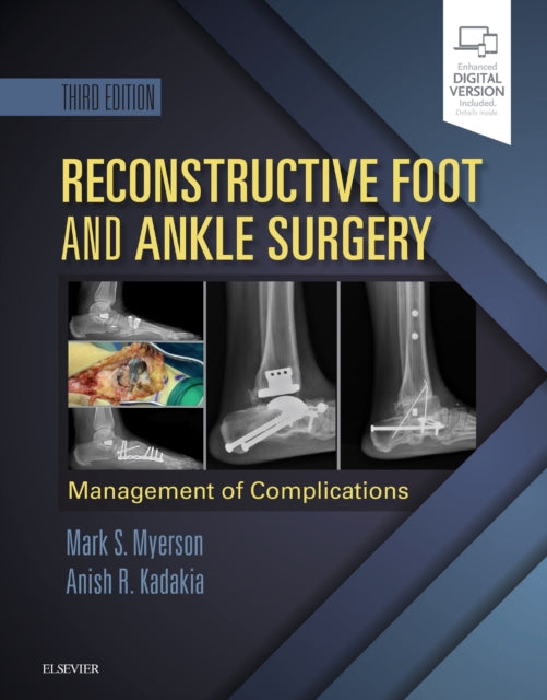 Book cover of: Reconstructive Foot and Ankle Surgery: Management of Complications. By: Mark S. Myerson