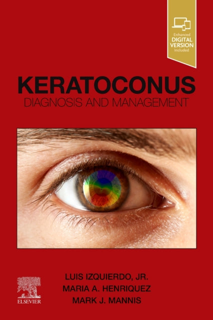 Book cover of: Keratoconus. By: Luis Izquierdo