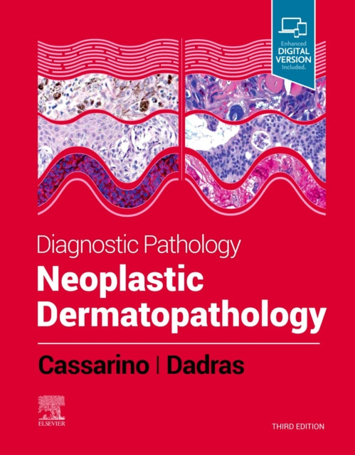 Book cover of: Diagnostic Pathology: Neoplastic Dermatopathology. By: David S. Cassarino MD  PhD