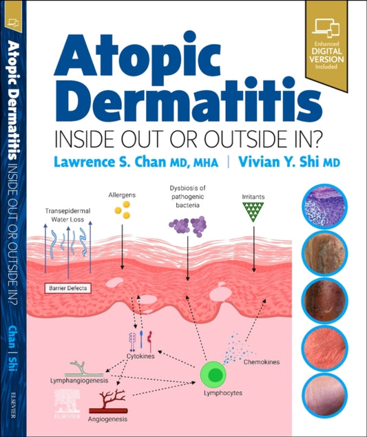 Book cover of: Atopic Dermatitis: Inside Out or Outside In. By: Lawrence S. Chan