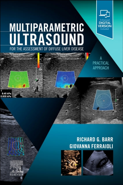 Book cover of: Multiparametric Ultrasound for the Assessment of Diffuse Liver Disease. By: Richard G. Barr