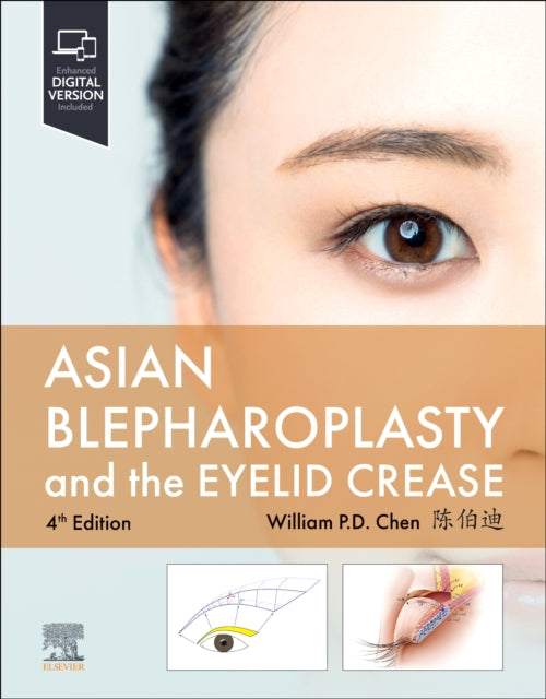 Book cover of: Asian Blepharoplasty and the Eyelid Crease. By: William P. Chen