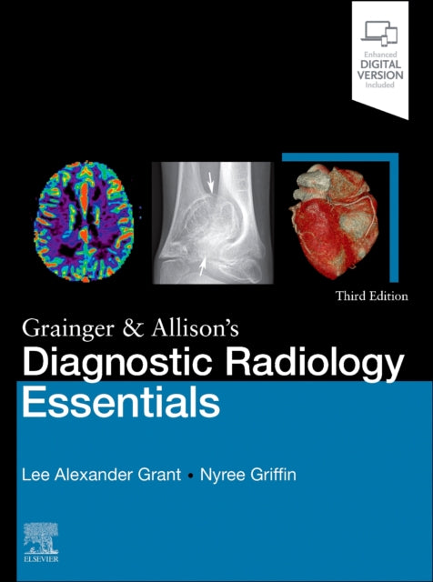 Book cover of: Grainger & Allison's Diagnostic Radiology Essentials. By: Lee A. Grant