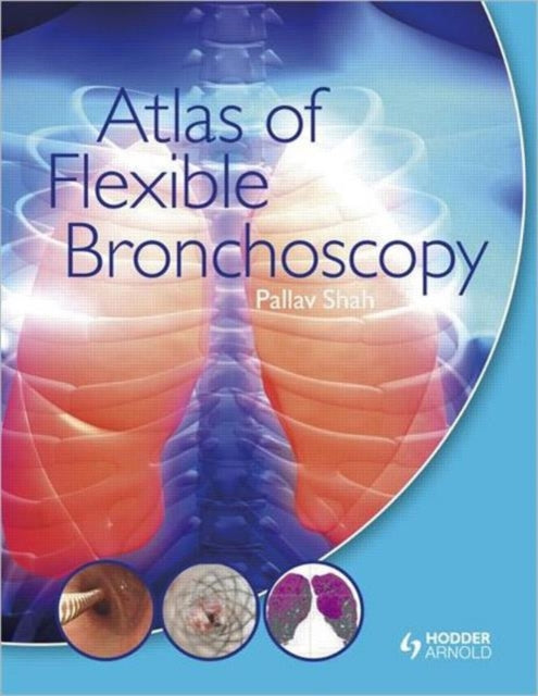 Book cover of: Atlas of Flexible Bronchoscopy