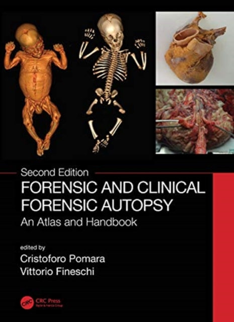 Book cover of: Forensic and Clinical Forensic Autopsy. By: Cristoforo Pomara