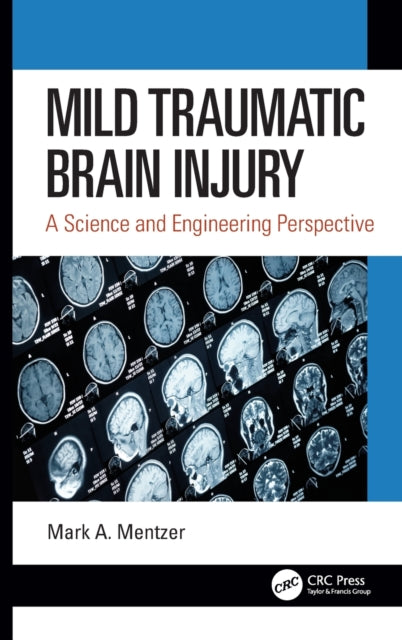 Book cover of: Mild Traumatic Brain Injury. By: Mark A. Mentzer