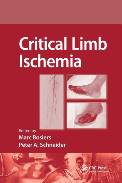 Book cover of: Critical Limb Ischemia. By: Marc Bosiers