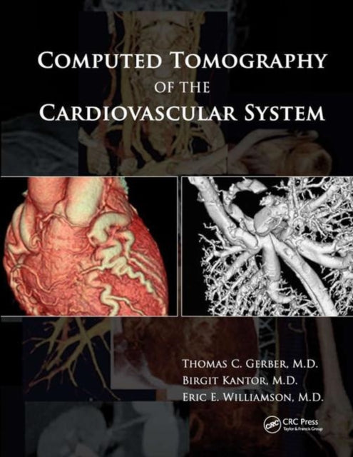 Book cover of: Computed Tomography of the Cardiovascular System. By: Thomas C. Gerber