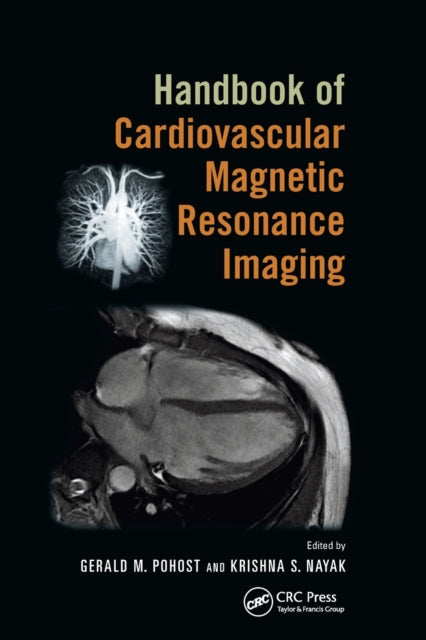 Book cover of: Handbook of Cardiovascular Magnetic Resonance Imaging. By: Gerald M. Pohost