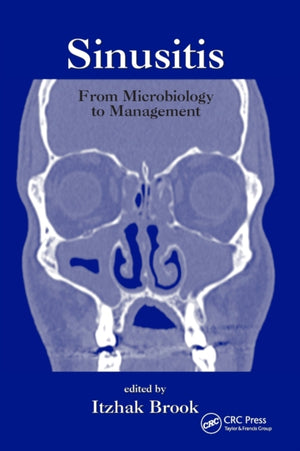 Sinusitis