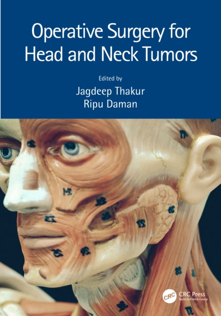 Book cover of: Operative Surgery for Head and Neck Tumors. By: Jagdeep Thakur