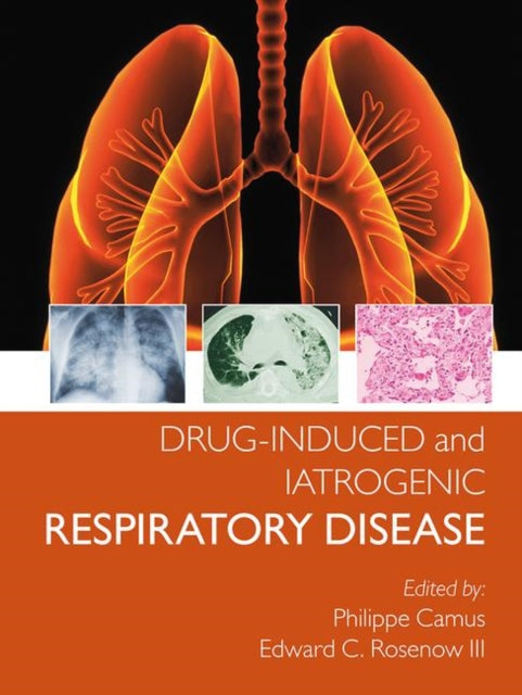 Book cover of: Drug-induced and Iatrogenic Respiratory Disease