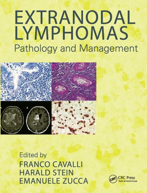 Book cover of: Extranodal Lymphomas. By: Franco Cavalli